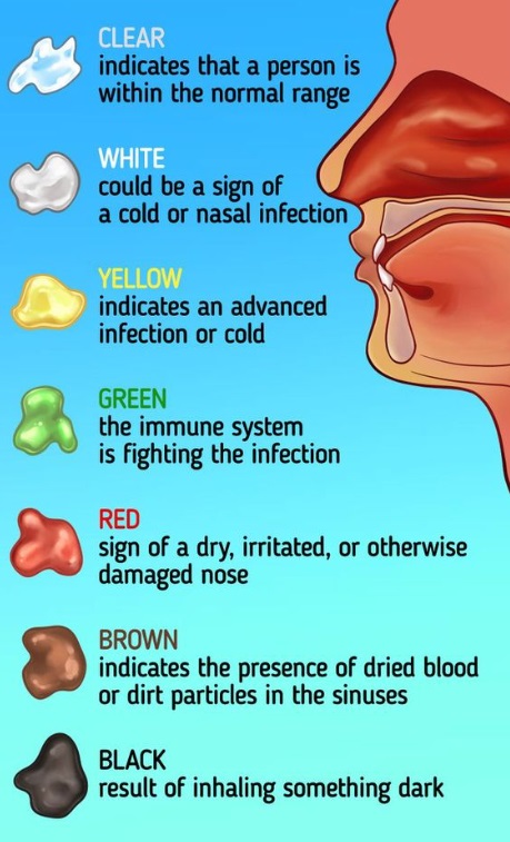 Illustration detailing characteristics of different types of nasal discharge 